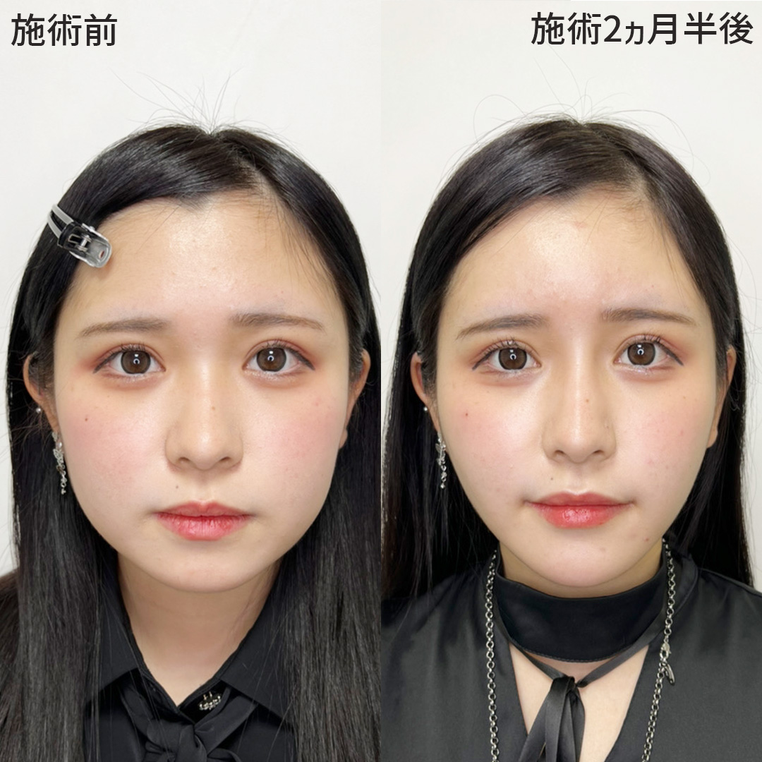 【垢抜けイメチェン】驚異の変化率が欲しい方へ