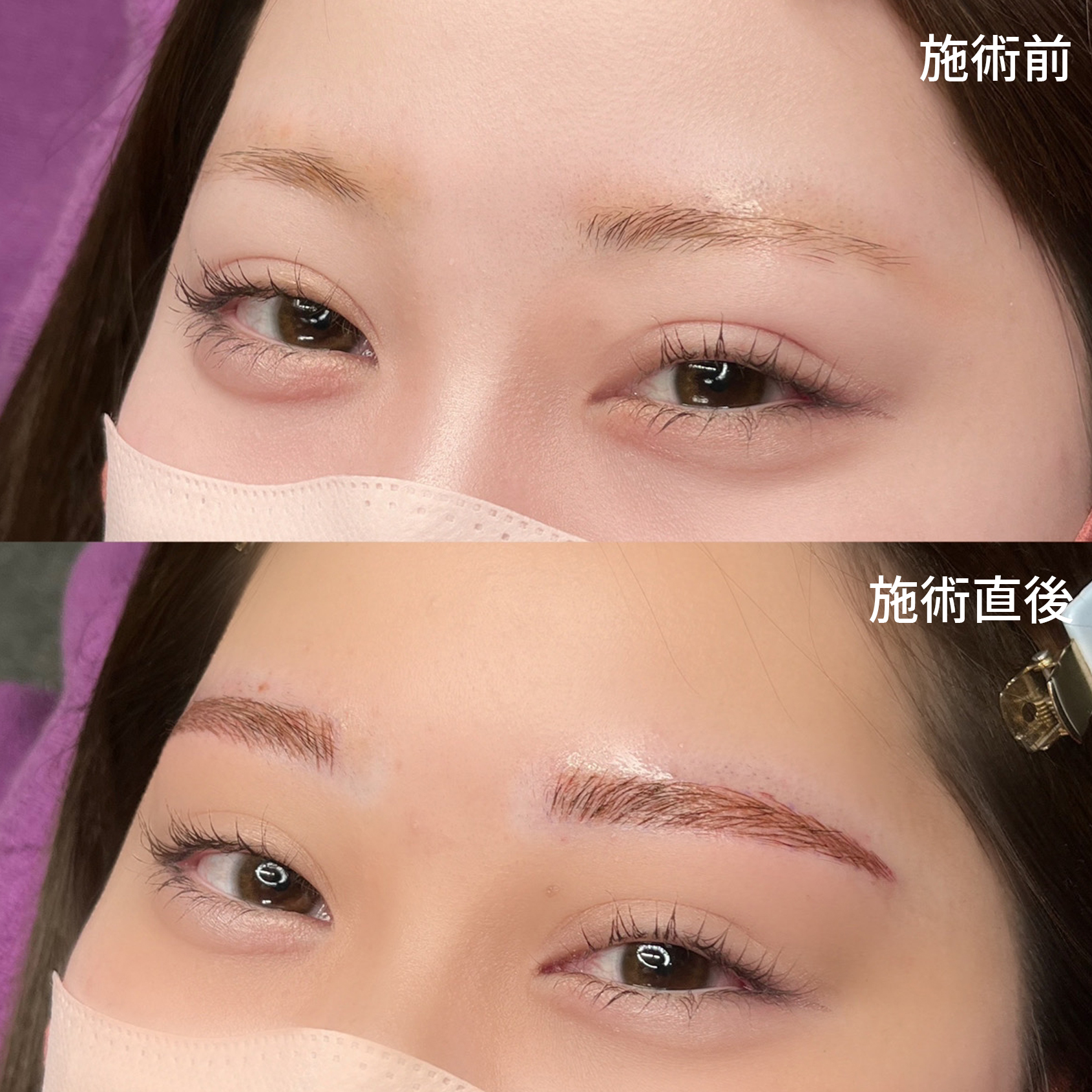 自然な毛並みでふんわり眉【メディカルアートメイク】