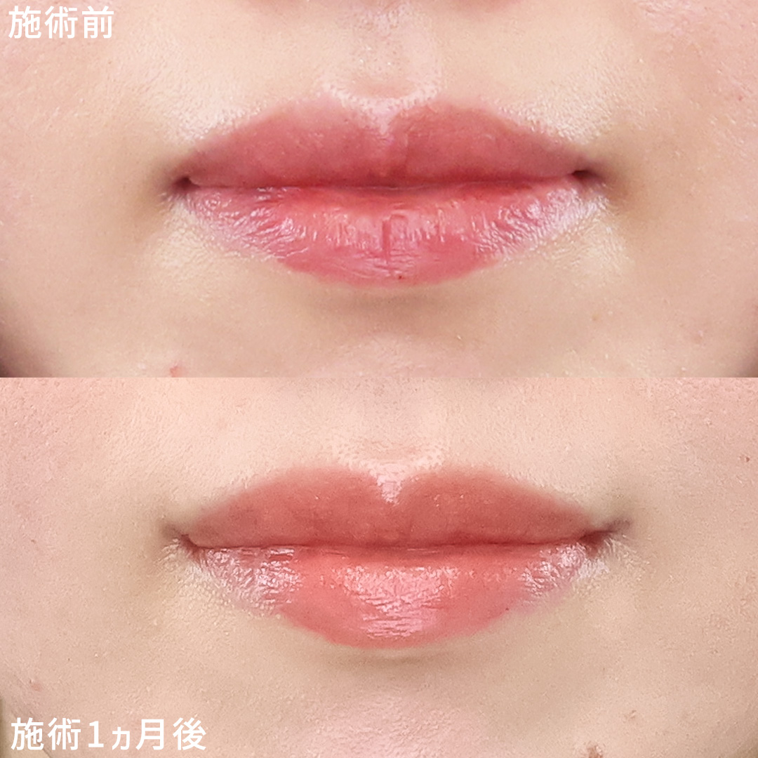 口角が上がるだけで自然に垢抜け