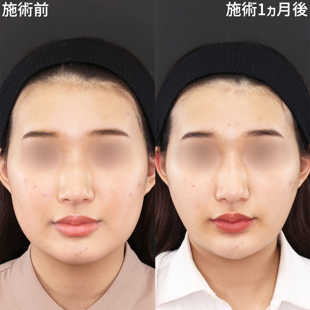 自分の輪郭に自信をもつ《パーフェクトフェイスライン》