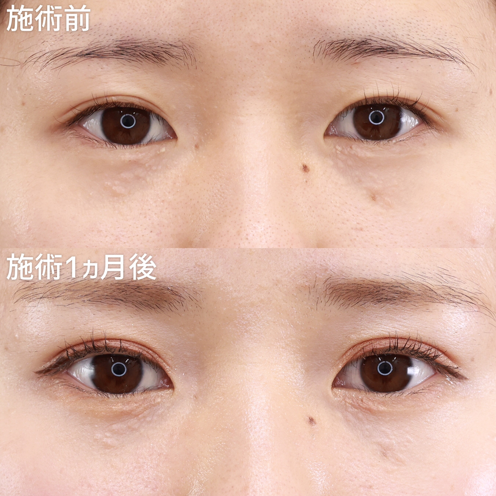 【クイックコスメリング】二重幅を広げてパッと華やかな目元に