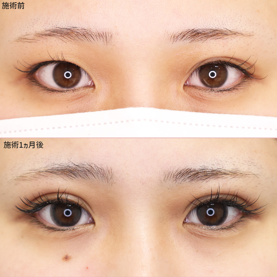 《埋没法》で大きなドーリーアイに