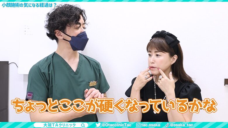 施術後1ヵ月の経過として、口元のちょっと硬くなっている部分を話す女性