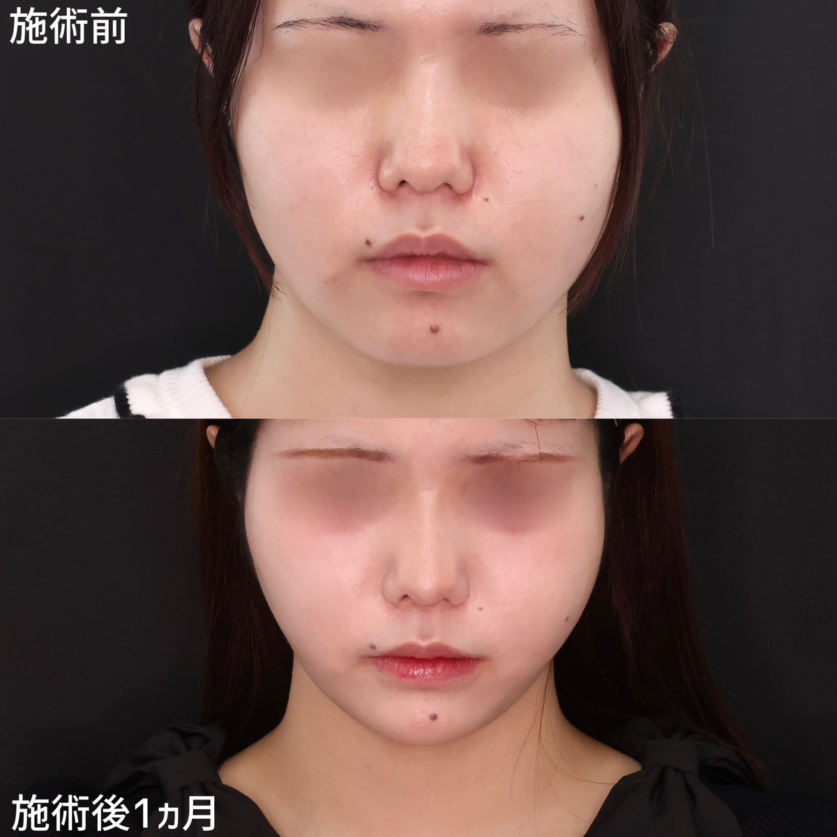 シャープな逆三角形で垢抜けフェイス！