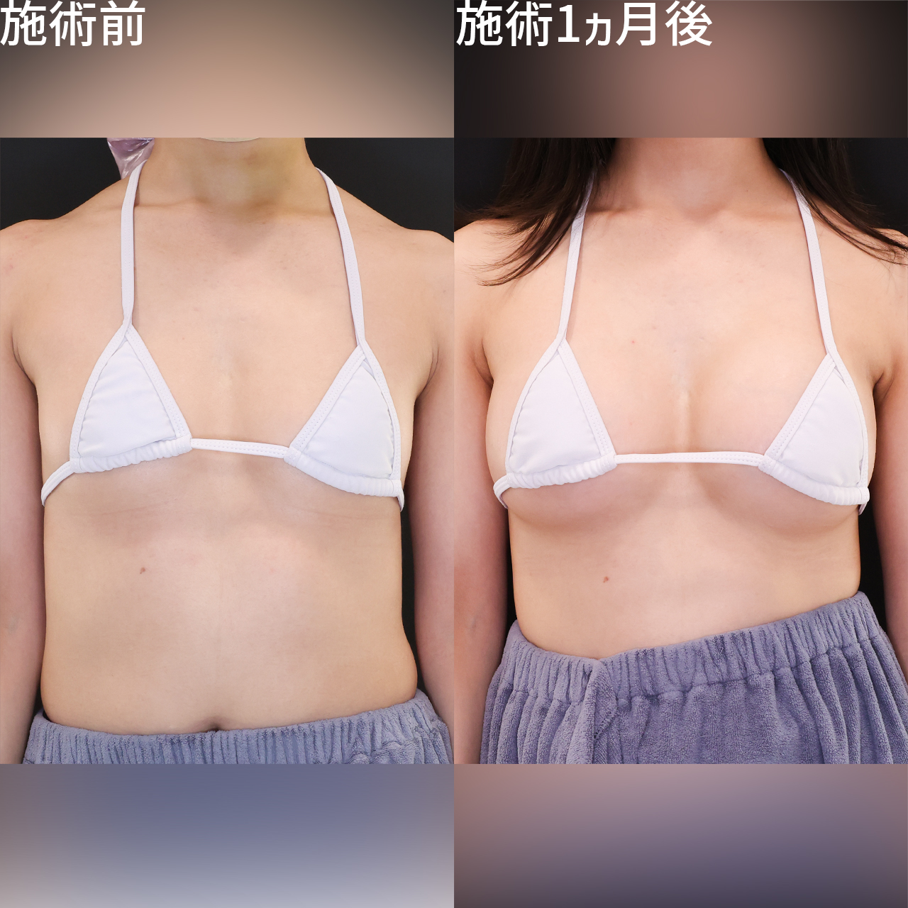 おっぱい 見た目