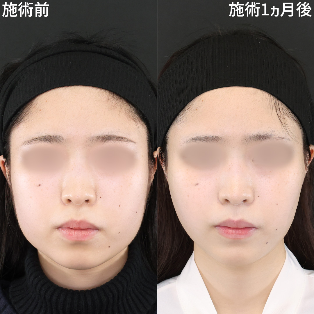 新社会人応援！新生活を小顔で！！