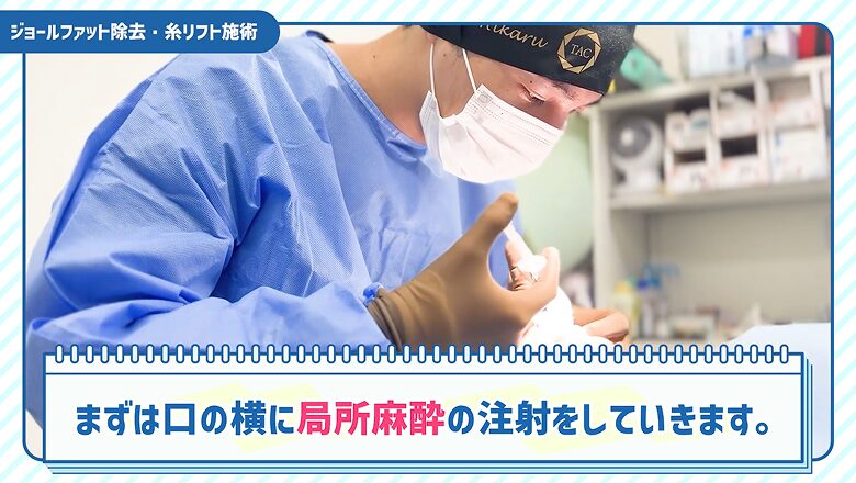 施術の痛みを抑えるために口横へ局所麻酔を注射する様子
