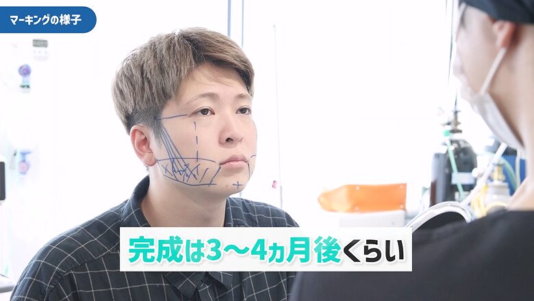 顔にマーキングを施し仕上がり時期を説明