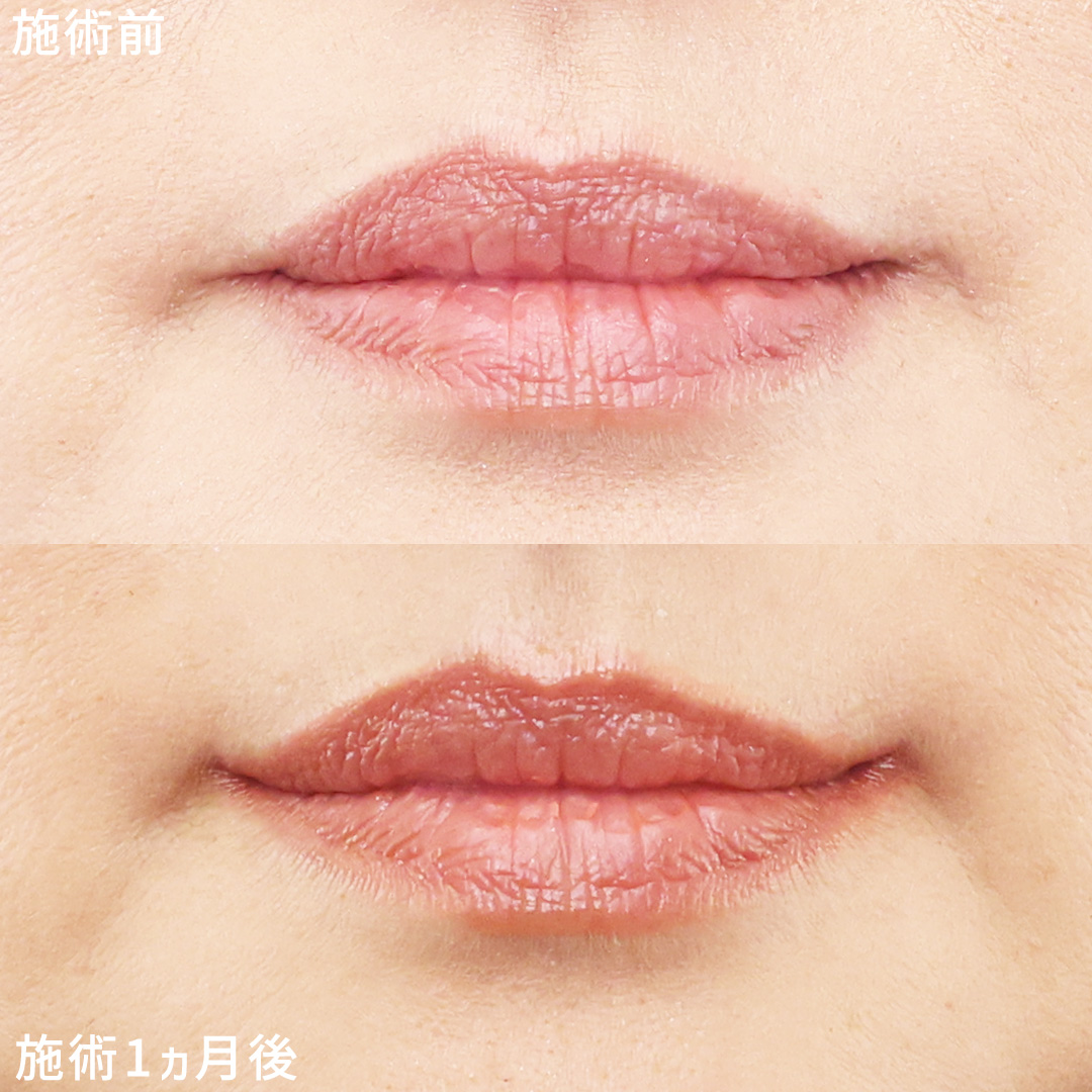 口角が上がるだけで明るい印象に◎