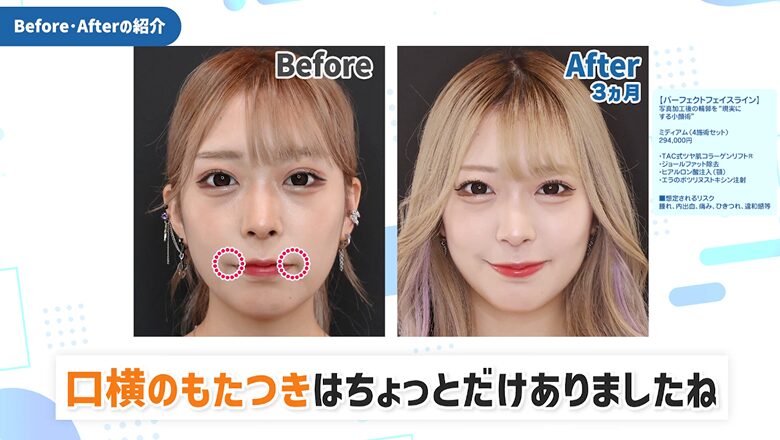 あむさんの症例写真