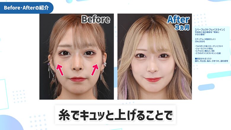 あむさんの症例写真2