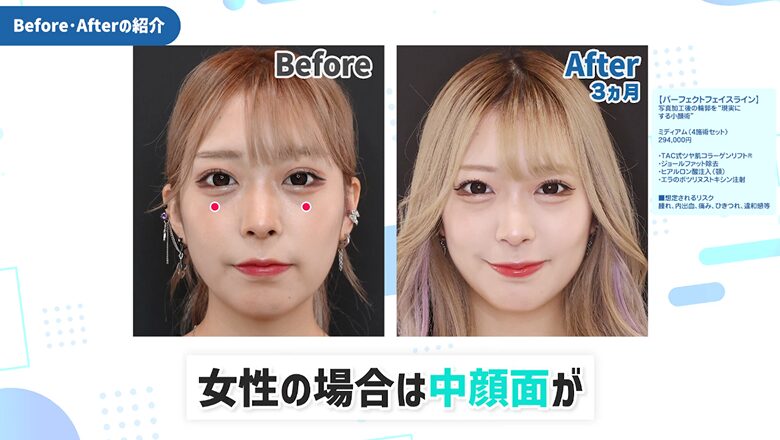 あむさんの症例写真3