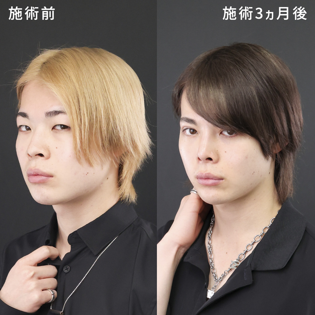セレクト美容塾・眼瞼 セレクト美容塾・眼瞼 改訂第2版 | 克誠堂出版