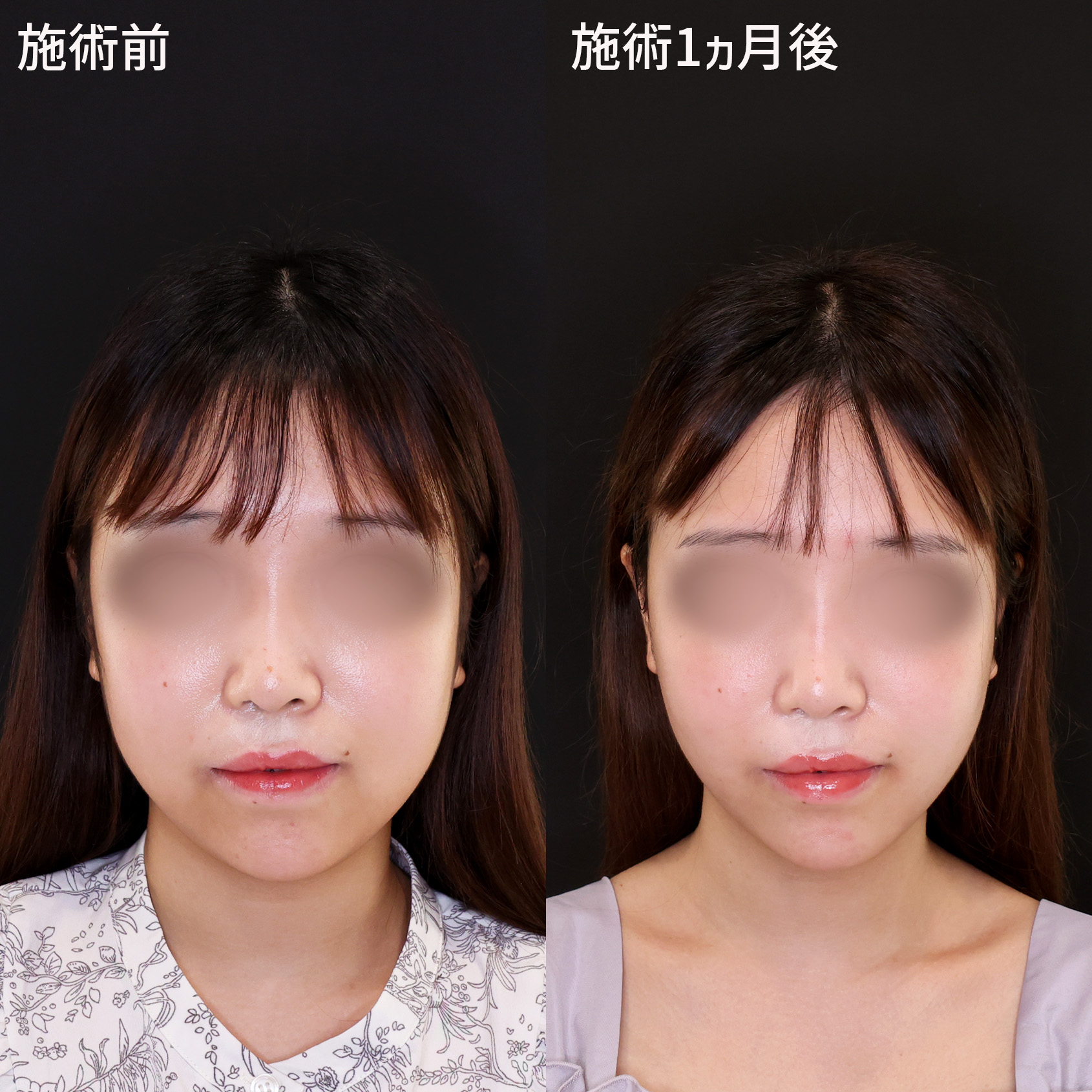 ムダな脂肪をメラメラ燃やす本 １カ月でやせる驚異のシェイプアップ法/講談社/伊藤雄康（新書） Yahoo!オークション - ◯1ヶ月でやせる驚異のシェイプアップ法
