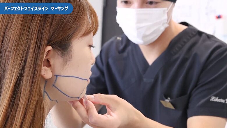 理想のフェイスラインを作るための入念なマーキング