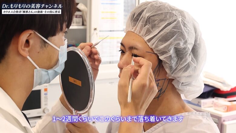 術後のダウンタイムの目安について説明を受ける楓雅さん