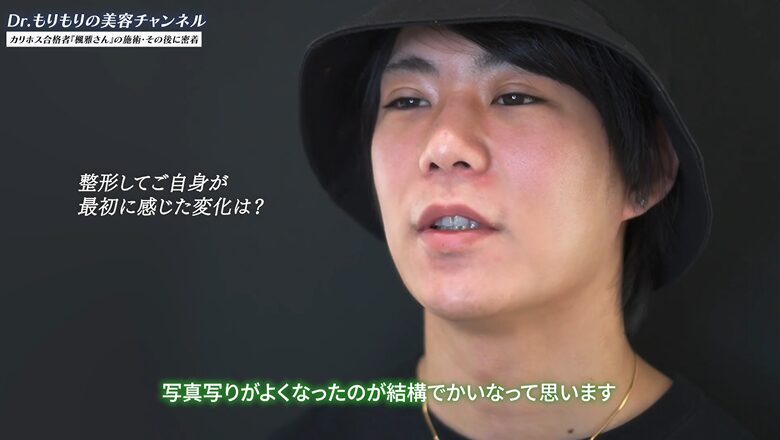 術後3カ月で写真写りが劇的に良くなったと語る楓雅さん