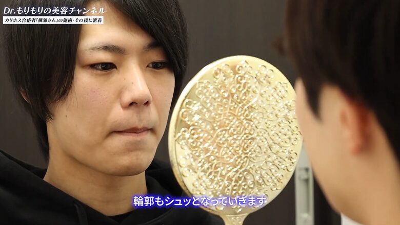 輪郭がスッキリ整う説明を受ける楓雅さん