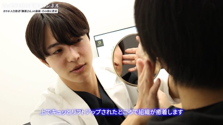 糸リフトによる組織の癒着と効果を説明する森医師