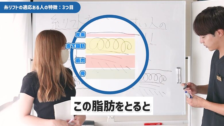 顔の皮膚構造の断面図と皮下脂肪を除去する解説図