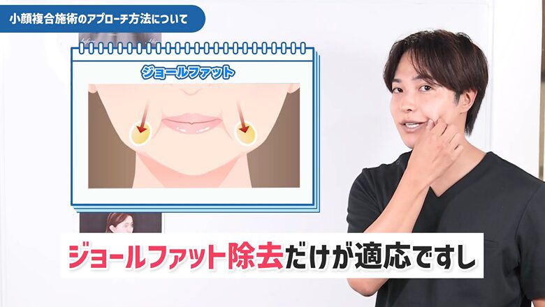 ジョールファット