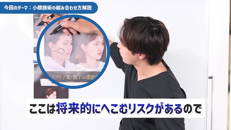 将来的に頬がこけるリスクのある部位を解説