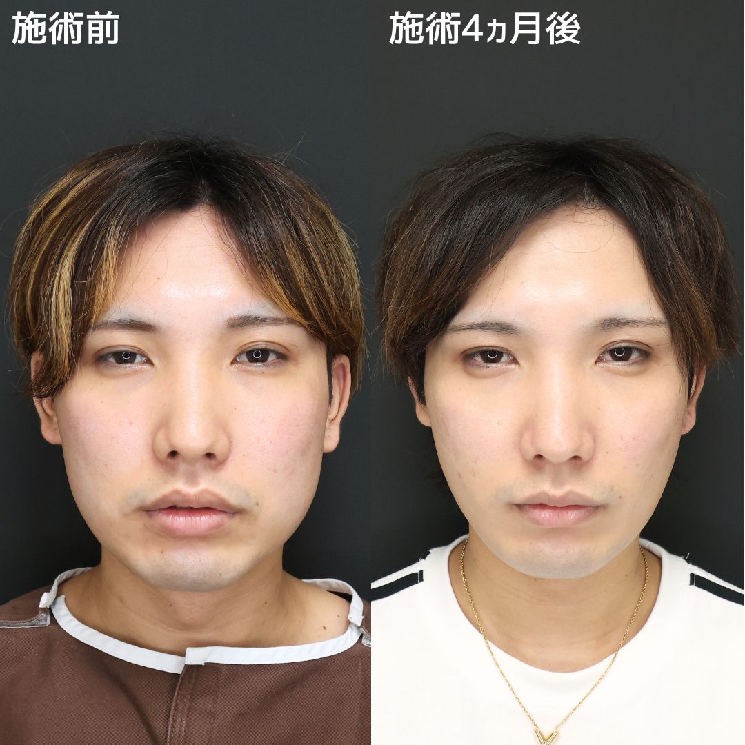 《男性美容》イケメンレベルもワンランクアップ！