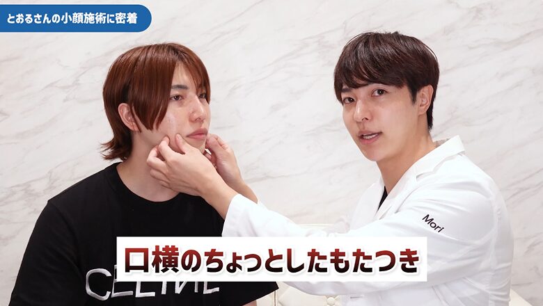 森医師が口横の脂肪の状態を確認