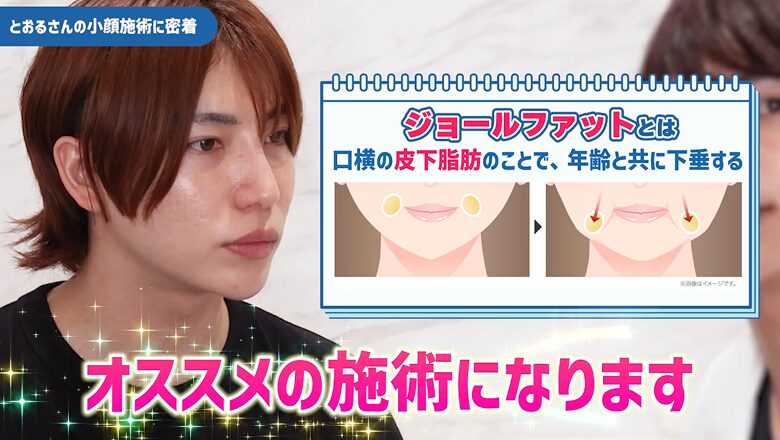 ジョールファットの解説図