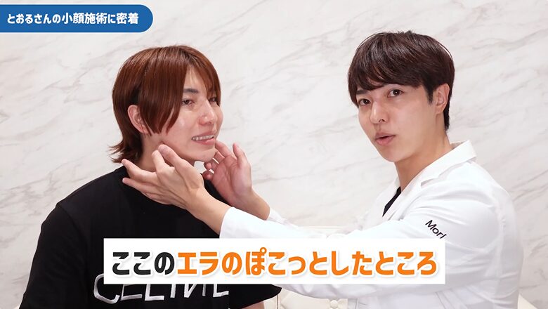 森医師がエラの張りを確認