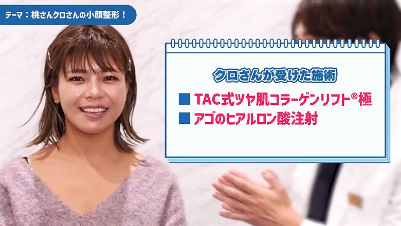 クロが受けた糸リフトとアゴのヒアルロン酸注射