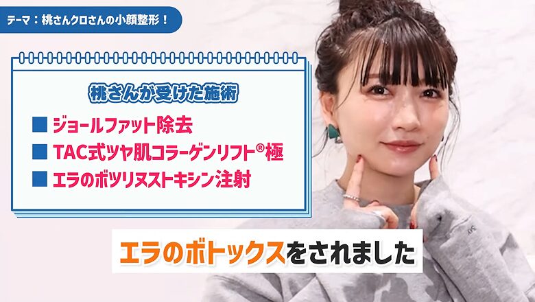 桃が受けたジョールファット除去・糸リフト・ボトックス