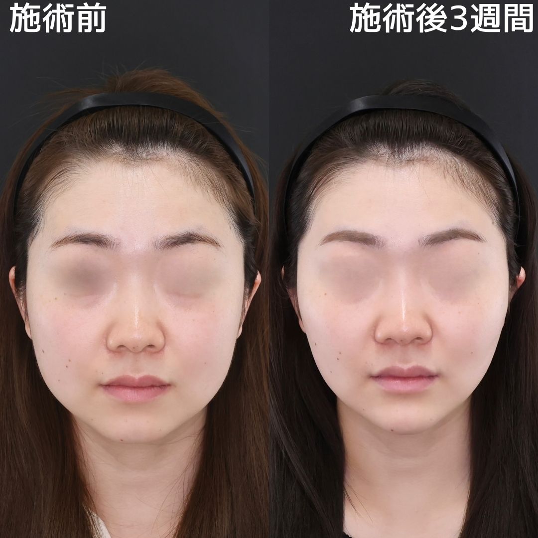 ふじた式整体科学 刻まれた不調の痕跡 瘢痕修正 | TETSU形成・美容クリニック 田中哲一郎のブログ