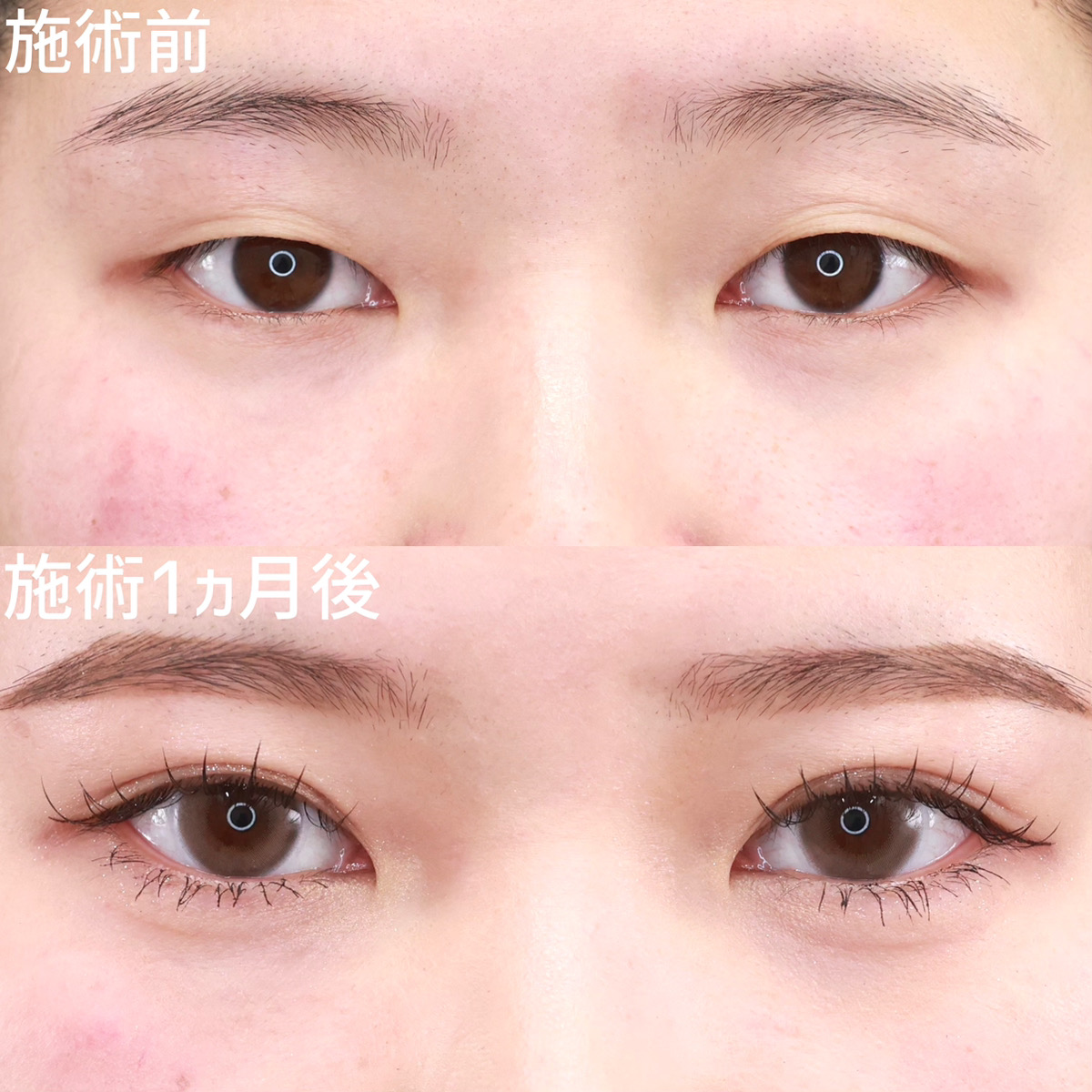 【二重埋没法】たった数分で印象激変！超絶映えるお目元に！