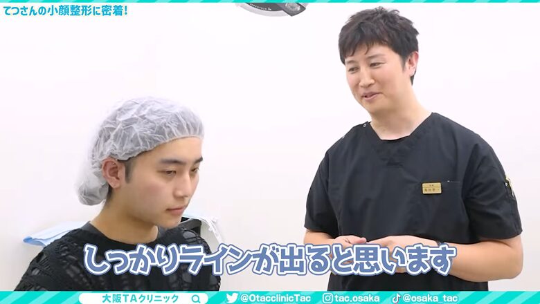 カウンセリングで仕上がりのフェイスラインについて説明