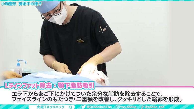 脂肪吸引を丁寧に行う手術中の様子