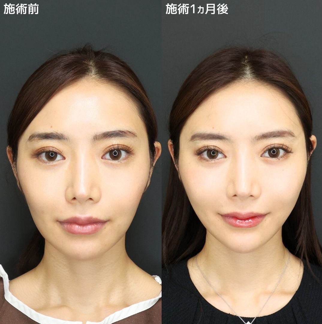 《プチ整形》モテる人はみんなやってる