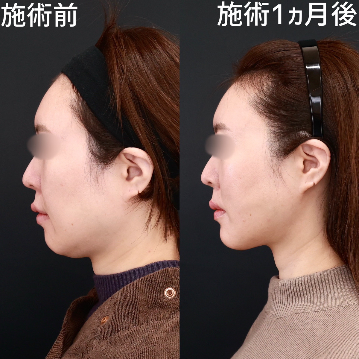 ムダな脂肪をメラメラ燃やす本 １カ月でやせる驚異のシェイプアップ法/講談社/伊藤雄康（新書） 日体大教授が教える 「脂肪燃焼」食 運動0でお腹が凹む! | 岡田
