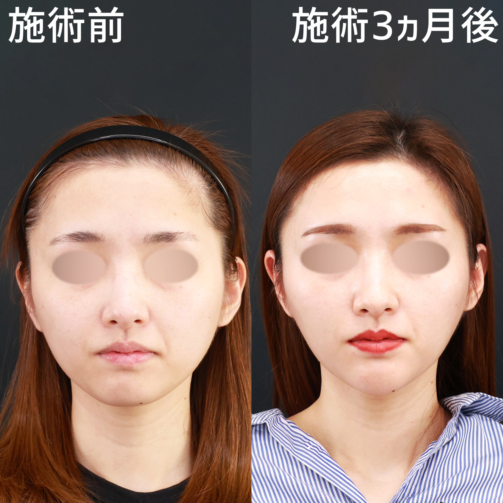 ムダな脂肪をメラメラ燃やす本 １カ月でやせる驚異のシェイプアップ法/講談社/伊藤雄康（新書） Yahoo!オークション - ◯1ヶ月でやせる驚異のシェイプアップ法
