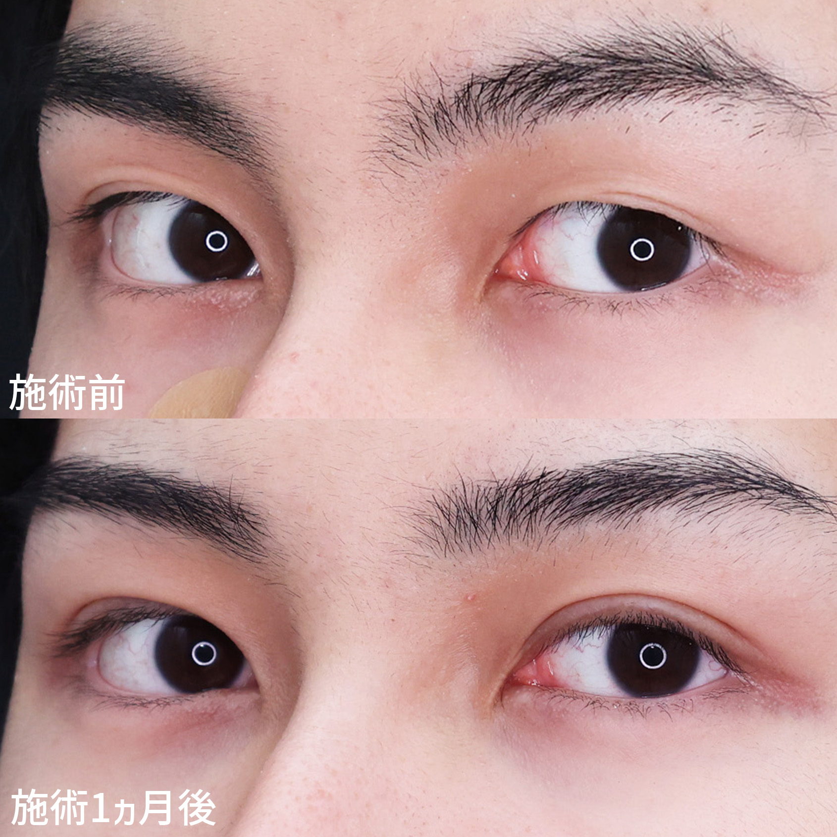 【埋没法】で優し気なイケメンにイメチェン！