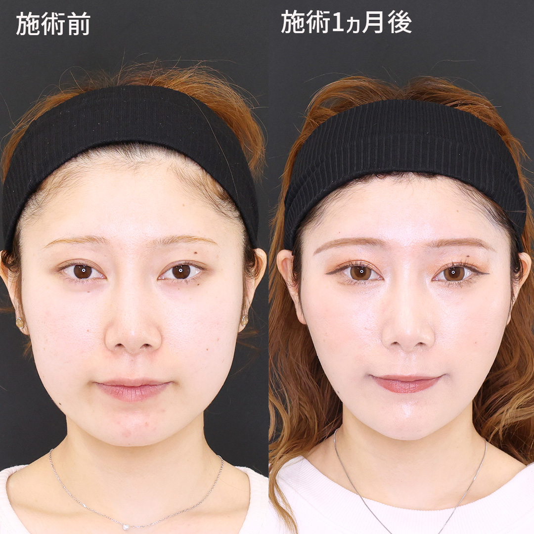 美しさを引き出す！女優級小顔術