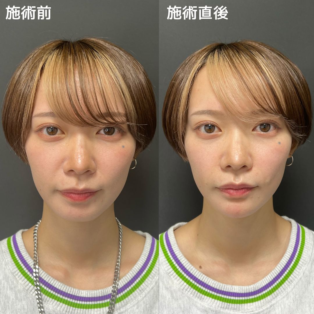 《施術時間10分》で長年のお悩みが即日改善