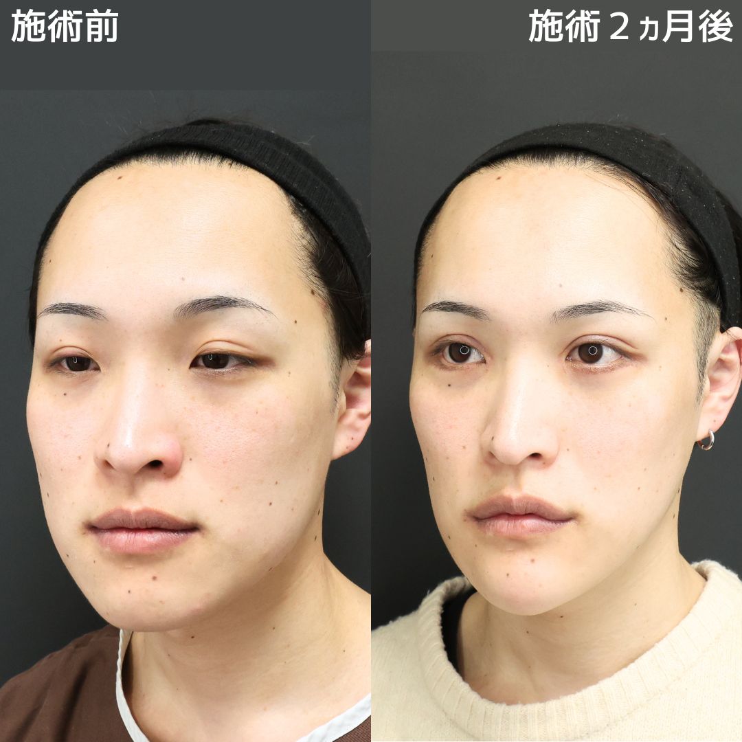《メンズ美容》Dr.Marieのトータルビューティー