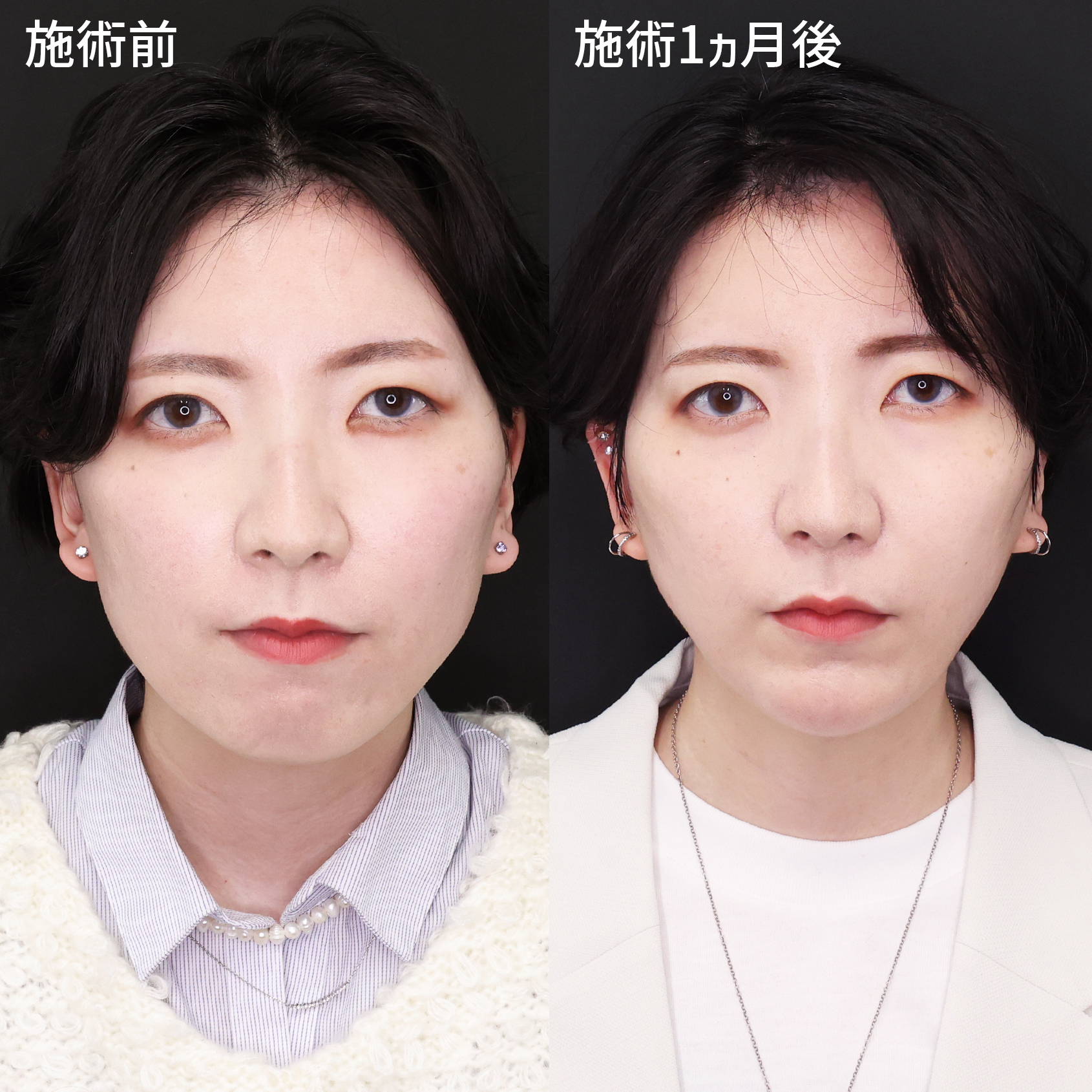 加工無しでも自信の持てる輪郭に◎