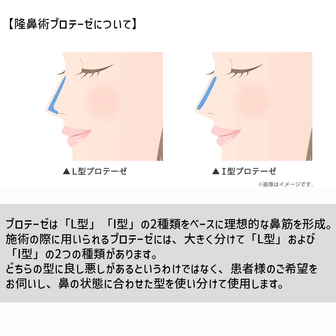 鼻中隔延長術/鼻先軟骨移植/鼻尖形成・鼻尖縮小の症例写真 施術前後 