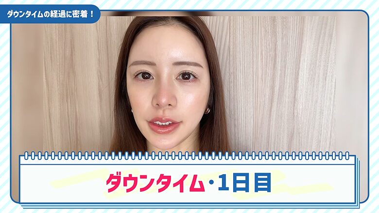 糸リフト施術から1日経過したダウンタイムの様子