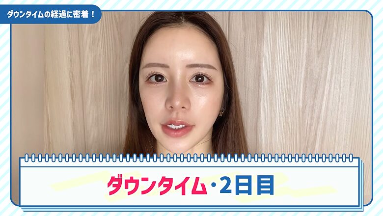 糸リフト施術から2日経過したダウンタイムの様子