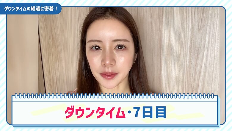 糸リフト施術から7日経過したダウンタイムの様子