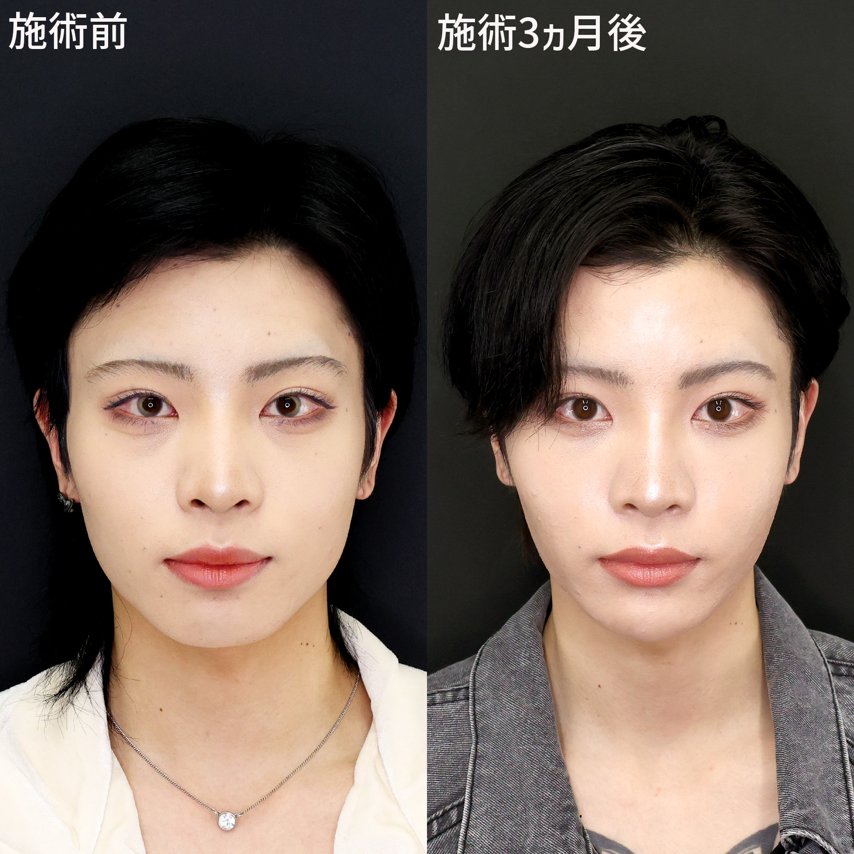 複合施術で叶えるDr.もりもりのトータルプロデュース