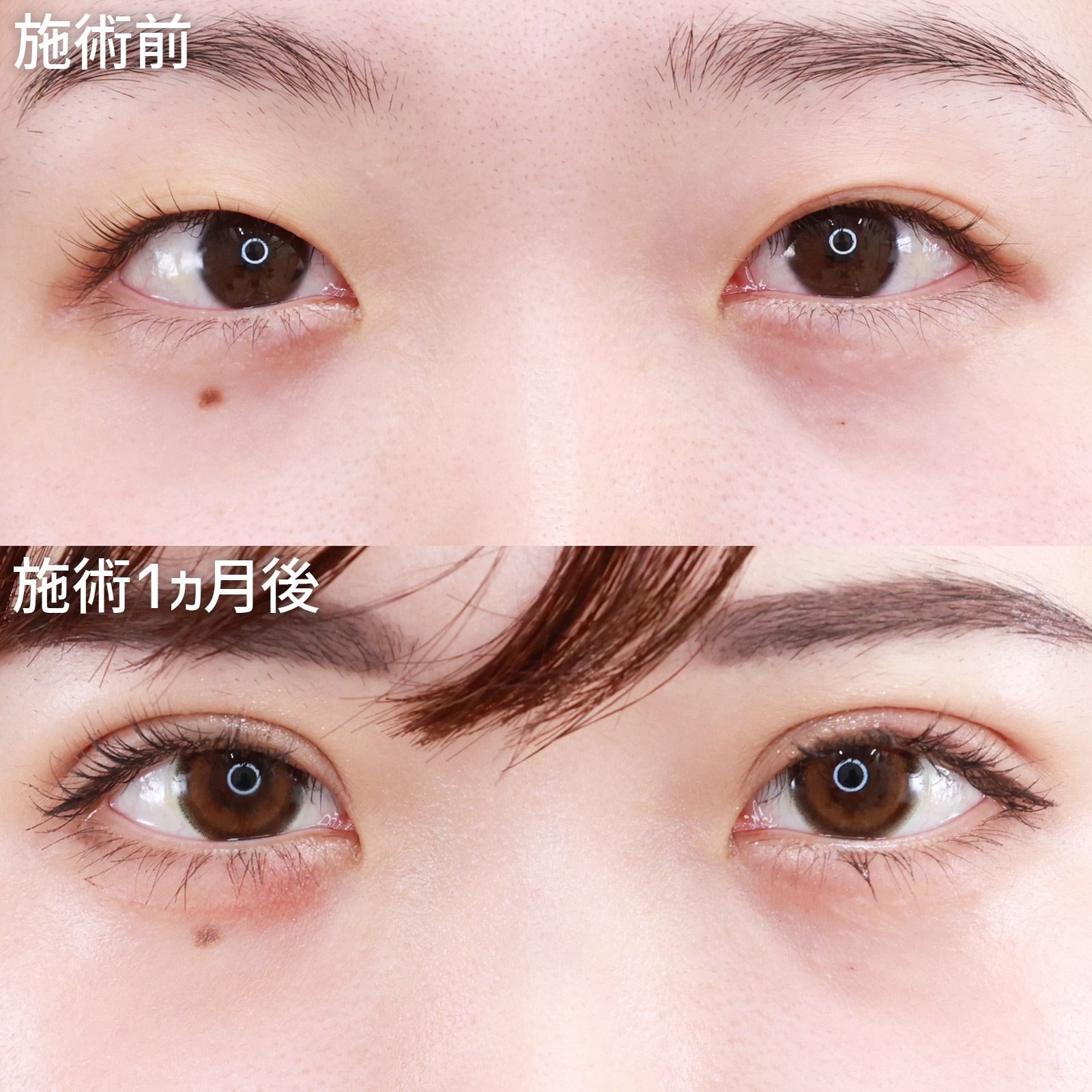 【クイックコスメリング】目を閉じてもナチュラルな仕上がり！理想的なMix二重に大変身